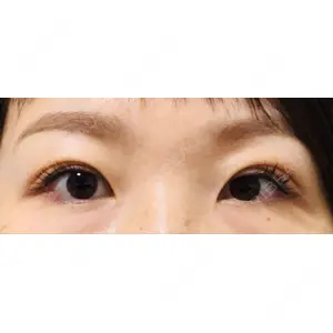 口コミ