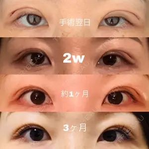 口コミ