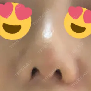 HANABI整形外科口コミ