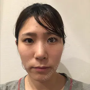 ソウルクイーン整形外科（旧コエンミ整形外科）口コミ
