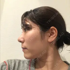 ソウルクイーン整形外科（旧コエンミ整形外科）口コミ
