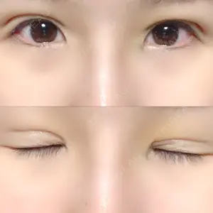 湘南美容クリニック 湘南美容クリニック 宇都宮院口コミ