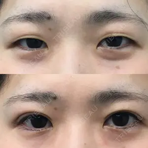 湘南美容クリニック 湘南美容クリニック 宇都宮院口コミ