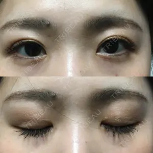 湘南美容クリニック 湘南美容クリニック 宇都宮院口コミ