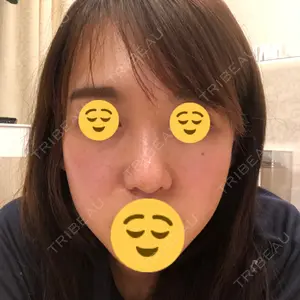HANABI整形外科口コミ