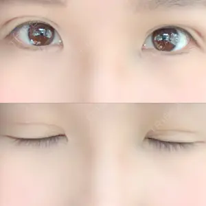 湘南美容クリニック 湘南美容クリニック 宇都宮院口コミ