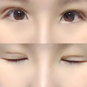 湘南美容クリニック 湘南美容クリニック 宇都宮院口コミ