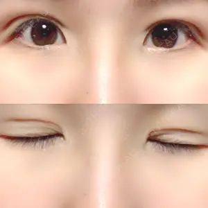 湘南美容クリニック 湘南美容クリニック 宇都宮院口コミ