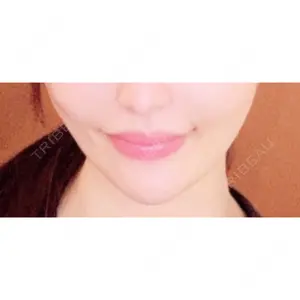 口コミ