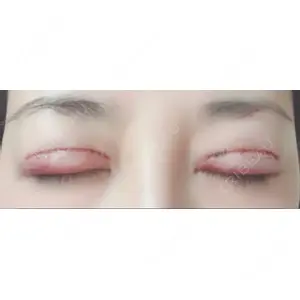 口コミ
