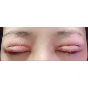 口コミ