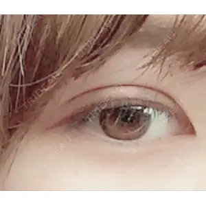 口コミ