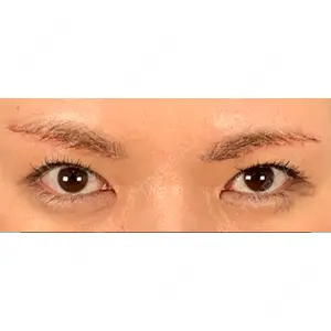 湘南美容クリニック 湘南美容クリニック 宇都宮院口コミ