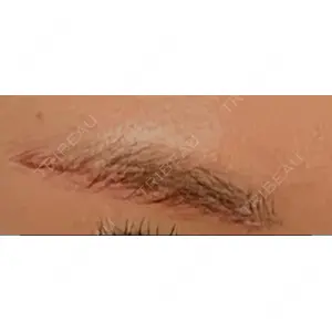 湘南美容クリニック 湘南美容クリニック 宇都宮院口コミ