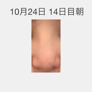口コミ