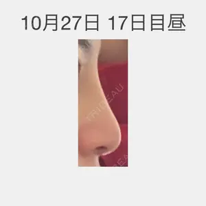 口コミ