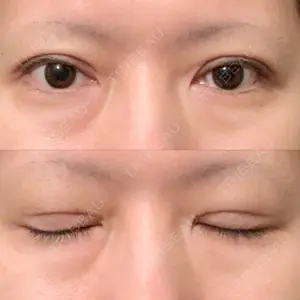 東京イセアクリニック口コミ