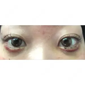 コムロクリニック コムロクリニック 東京銀座院口コミ