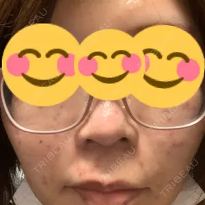 南青山TOKUNAKAクリニック口コミ
