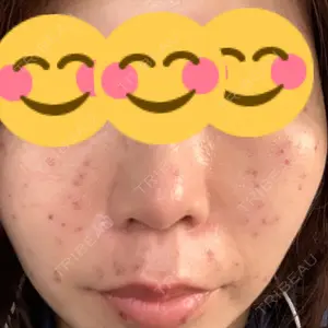 南青山TOKUNAKAクリニック口コミ