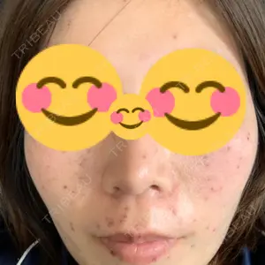 南青山TOKUNAKAクリニック口コミ