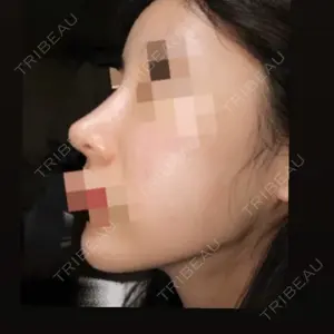 口コミ