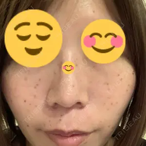 南青山TOKUNAKAクリニック口コミ