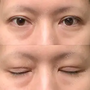 東京イセアクリニック口コミ