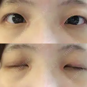 口コミ