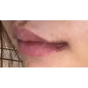 現代美学整形外科口コミ