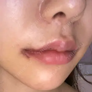 現代美学整形外科口コミ