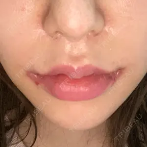 現代美学整形外科口コミ