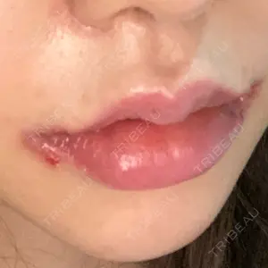 現代美学整形外科口コミ