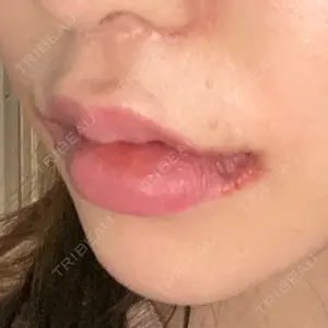 現代美学整形外科口コミ