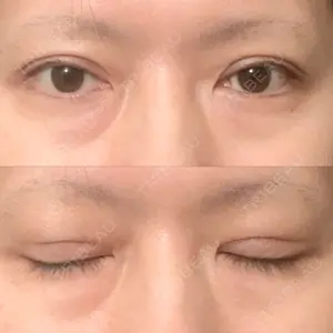 東京イセアクリニック口コミ