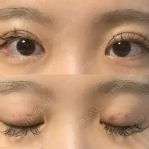 口コミ