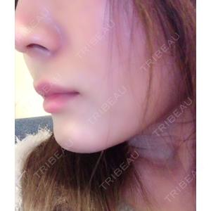 あいちビューティークリニック あいちビューティークリニック栄本院口コミ