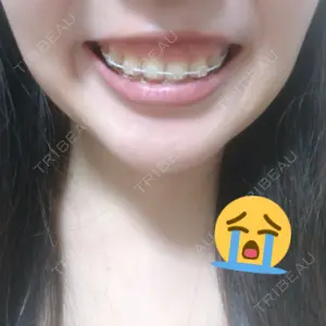 口コミ