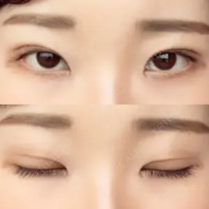 口コミ