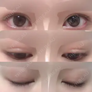 高須クリニック 銀座高須クリニック口コミ