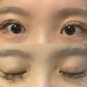 口コミ