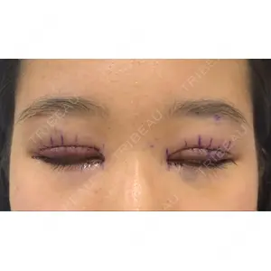 Lovelyan整形外科口コミ