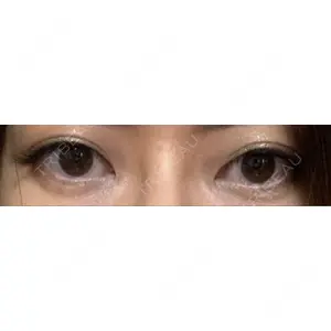口コミ