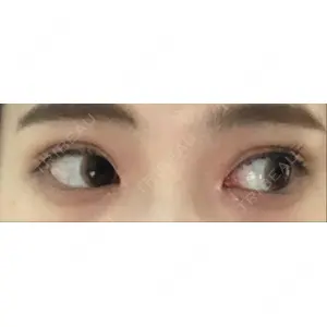 プロミス整形外科口コミ