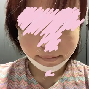 ウィーバー美容外科口コミ