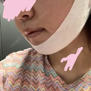 ウィーバー美容外科口コミ