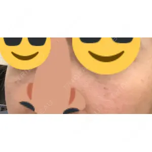 口コミ