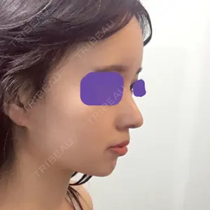 口コミ