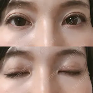 口コミ