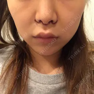 口コミ